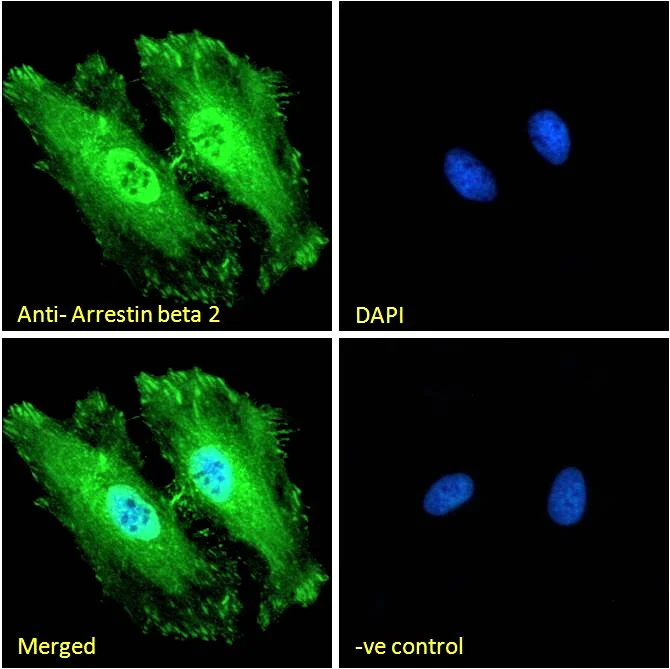 Immunocytochemistry - Anti-Beta Arrestin 2 antibody (AB31294)