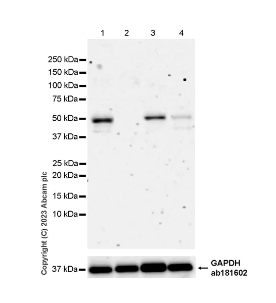 Western blot - Anti-Beta Arrestin 2 antibody [EPR25410-70] - BSA and Azide free (AB314214)