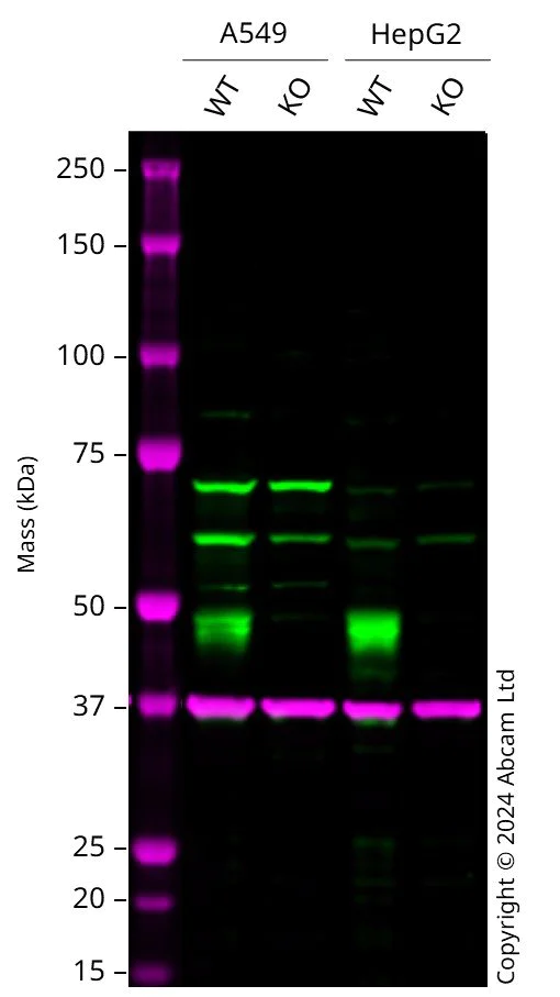 Western blot - Anti-Beta Arrestin 2 antibody [EPR25410-70] - BSA and Azide free (AB314214)