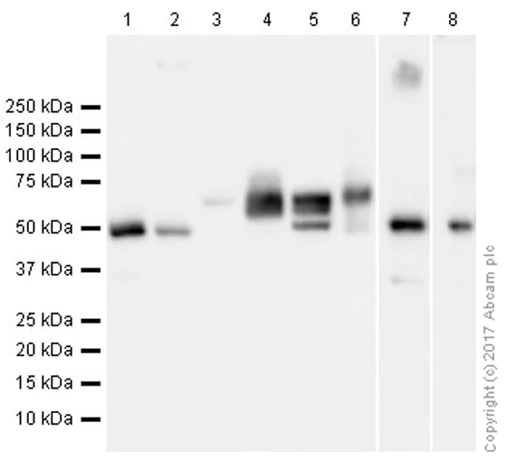 Western blot - Anti-Beta Arrestin 2 + Beta Arrestin 1 antibody [EPR22073] (AB206972)