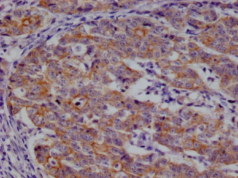 Immunohistochemistry (Formalin/PFA-fixed paraffin-embedded sections) - Anti-beta Casein antibody [29D6] (AB314186)