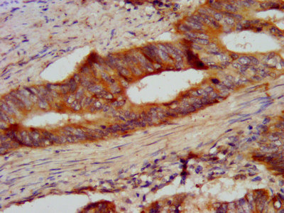 Immunohistochemistry (Formalin/PFA-fixed paraffin-embedded sections) - Anti-beta Casein antibody (AB236290), expandable thumbnail