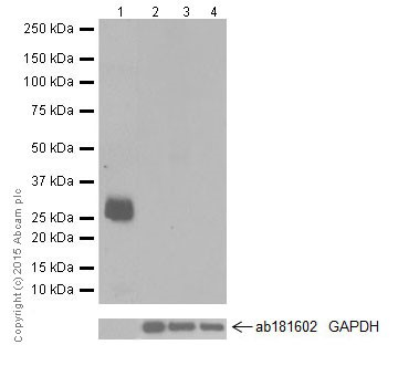 Western blot - Anti-beta Casein antibody [EPR12179] (AB205301)
