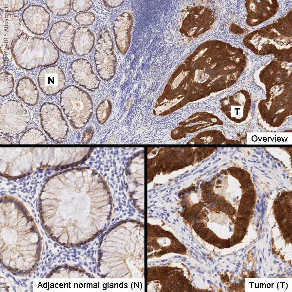Immunohistochemistry (Formalin/PFA-fixed paraffin-embedded sections) - Anti-beta Catenin antibody [12F7] (AB22656)