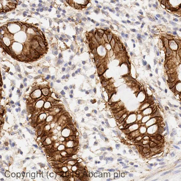 Immunohistochemistry (Formalin/PFA-fixed paraffin-embedded sections) - Anti-beta Catenin antibody [12F7] (AB22656)