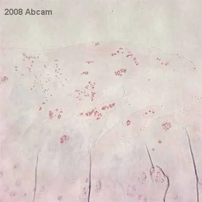 Immunohistochemistry (Formalin/PFA-fixed paraffin-embedded sections) - Anti-beta Catenin antibody [12F7] (AB22656)
