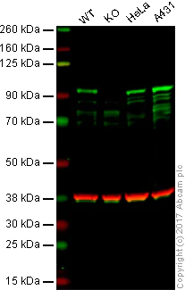 Western blot - Anti-beta Catenin antibody [12F7] (AB22656)