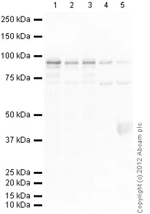 Western blot - Anti-beta Catenin antibody [15B8] (AB6301)