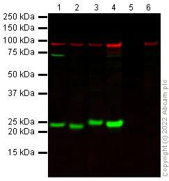 Western blot - Anti-beta Catenin antibody [15B8] (AB6301)