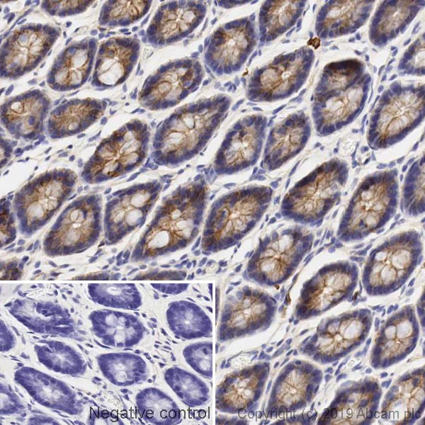 Immunohistochemistry (Formalin/PFA-fixed paraffin-embedded sections) - Anti-beta Catenin antibody [5H10] (AB231305)