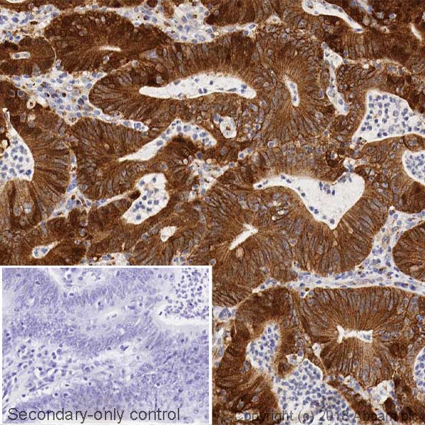 Immunohistochemistry (Formalin/PFA-fixed paraffin-embedded sections) - Anti-beta Catenin antibody [5H10] (AB231305)