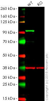 Western blot - Anti-beta Catenin antibody [5H10] (AB231305)