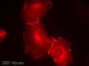 Immunocytochemistry/ Immunofluorescence - Anti-beta Catenin antibody (ab16051), expandable thumbnail