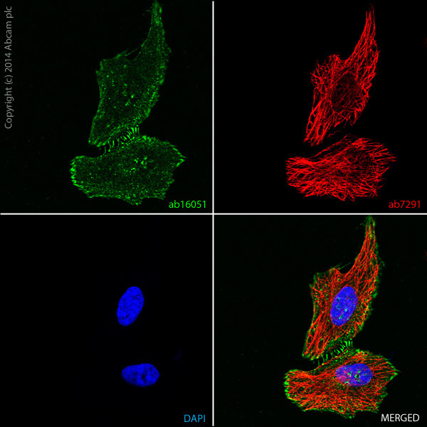Immunocytochemistry/ Immunofluorescence - Anti-beta Catenin antibody (AB16051), expandable thumbnail