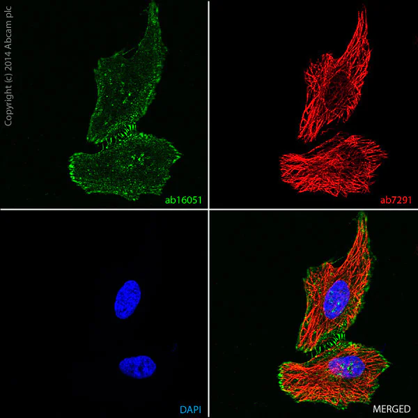 Immunocytochemistry/ Immunofluorescence - Anti-beta Catenin antibody (AB16051)