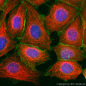 Immunocytochemistry/ Immunofluorescence - Anti-beta Catenin antibody (ab16051), expandable thumbnail