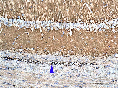 Immunohistochemistry (Formalin/PFA-fixed paraffin-embedded sections) - Anti-beta Catenin antibody (AB16051), expandable thumbnail