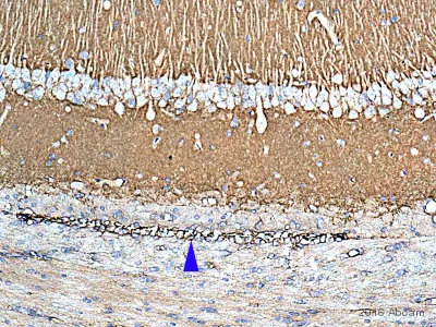 Immunohistochemistry (Formalin/PFA-fixed paraffin-embedded sections) - Anti-beta Catenin antibody (AB16051)