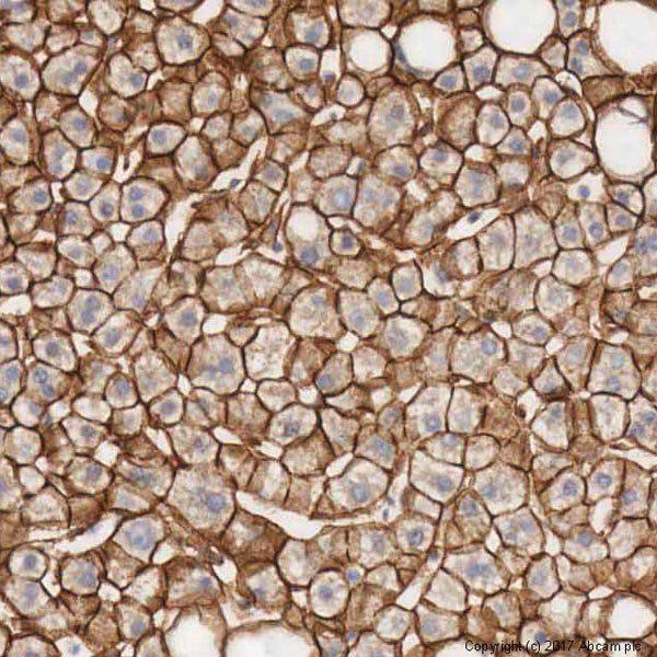 Immunohistochemistry (Formalin/PFA-fixed paraffin-embedded sections) - Anti-beta Catenin antibody (AB16051), expandable thumbnail