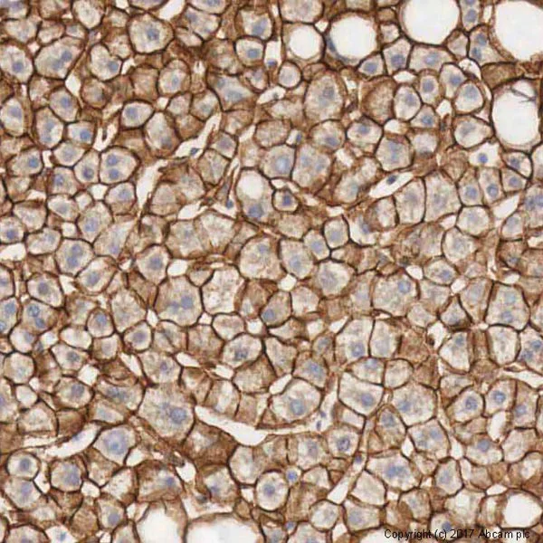 Immunohistochemistry (Formalin/PFA-fixed paraffin-embedded sections) - Anti-beta Catenin antibody (AB16051)