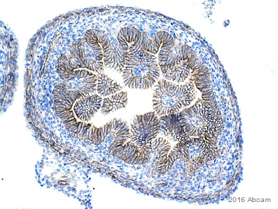 Immunohistochemistry (Formalin/PFA-fixed paraffin-embedded sections) - Anti-beta Catenin antibody (ab16051), expandable thumbnail