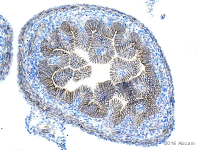 Immunohistochemistry (Formalin/PFA-fixed paraffin-embedded sections) - Anti-beta Catenin antibody (AB16051)