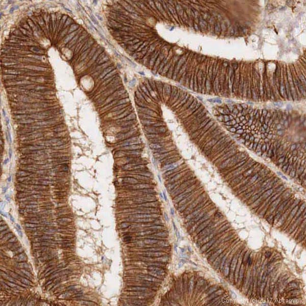 Immunohistochemistry (Formalin/PFA-fixed paraffin-embedded sections) - Anti-beta Catenin antibody (AB16051), expandable thumbnail