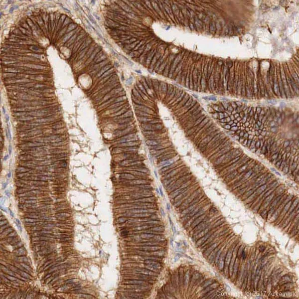 Immunohistochemistry (Formalin/PFA-fixed paraffin-embedded sections) - Anti-beta Catenin antibody (AB16051)