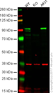 Western blot - Anti-beta Catenin antibody (AB16051)