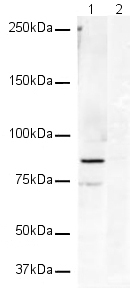 Western blot - Anti-beta Catenin antibody (ab16051), expandable thumbnail