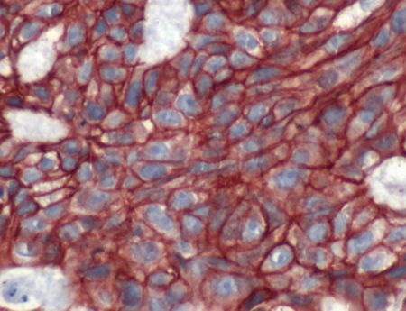 Immunohistochemistry (Formalin/PFA-fixed paraffin-embedded sections) - Anti-beta Catenin antibody (AB2365), expandable thumbnail