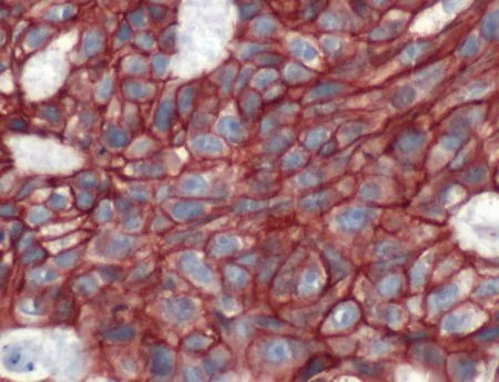 Immunohistochemistry (Formalin/PFA-fixed paraffin-embedded sections) - Anti-beta Catenin antibody (AB2365)