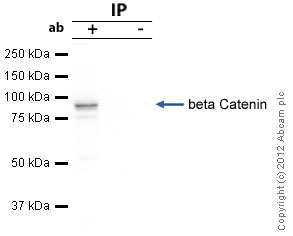 Immunoprecipitation - Anti-beta Catenin antibody (AB2365), expandable thumbnail