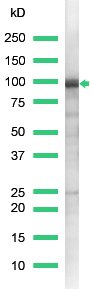 Western blot - Anti-beta Catenin antibody (AB2365), expandable thumbnail