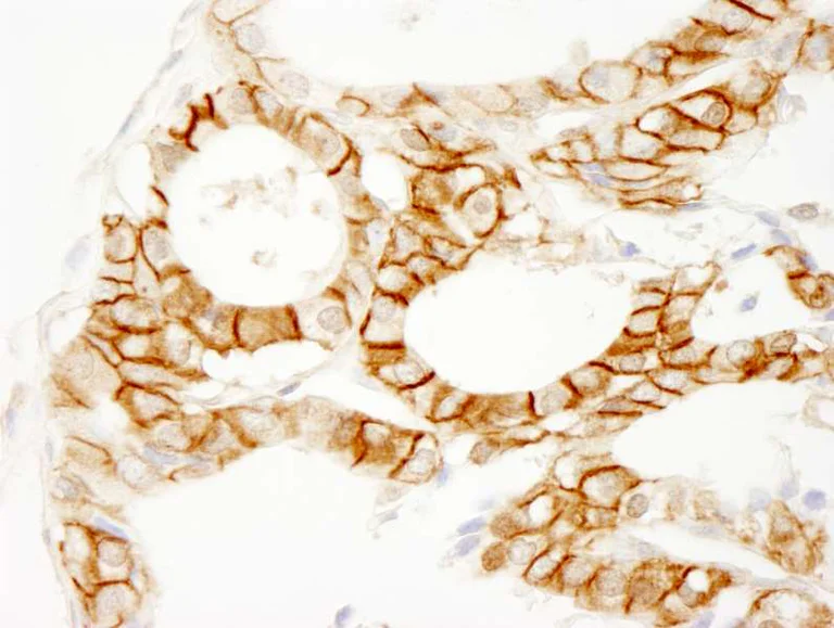 Immunohistochemistry (Formalin/PFA-fixed paraffin-embedded sections) - Anti-beta Catenin antibody (AB264261)