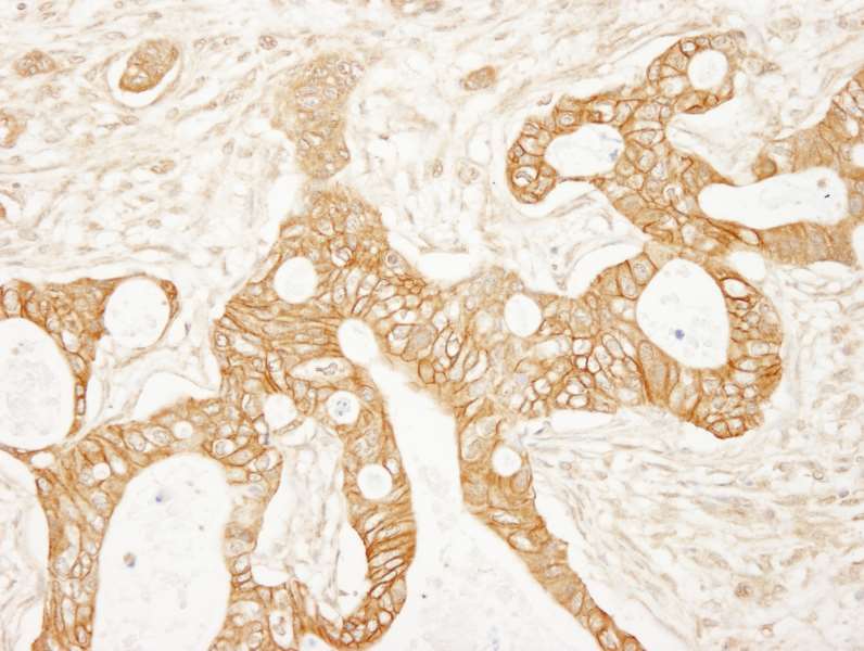Immunohistochemistry (Formalin/PFA-fixed paraffin-embedded sections) - Anti-beta Catenin antibody (AB264262), expandable thumbnail