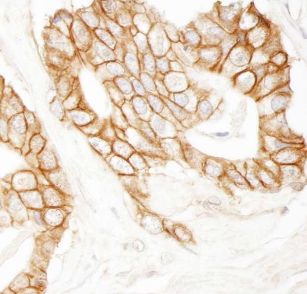 Immunohistochemistry (Formalin/PFA-fixed paraffin-embedded sections) - Anti-beta Catenin antibody (AB264263)