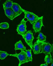 Immunocytochemistry/ Immunofluorescence - Anti-beta Catenin antibody (AB6302)