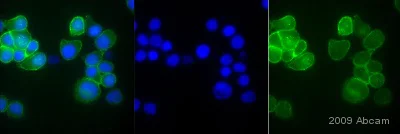 Immunocytochemistry/ Immunofluorescence - Anti-beta Catenin antibody (AB6302)