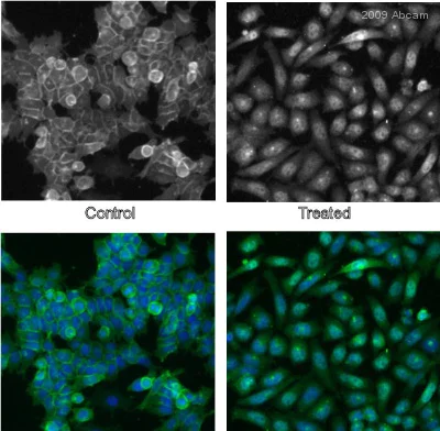 Immunocytochemistry/ Immunofluorescence - Anti-beta Catenin antibody (AB6302)