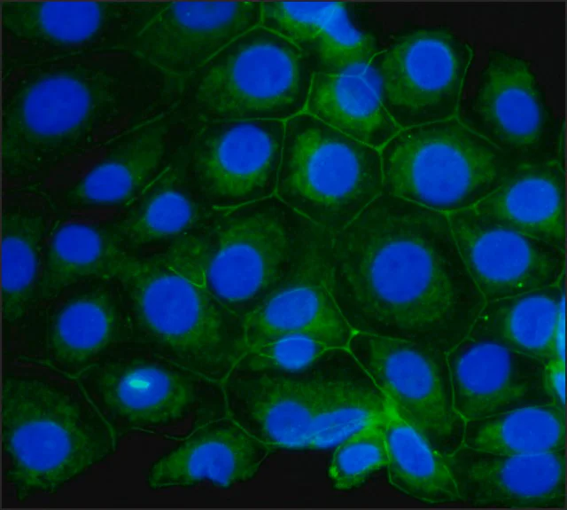 Immunocytochemistry/ Immunofluorescence - Anti-beta Catenin antibody (AB6302)