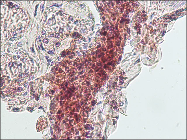 Immunohistochemistry (Formalin/PFA-fixed paraffin-embedded sections) - Anti-beta Catenin antibody (AB6302)