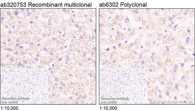Immunohistochemistry (Formalin/PFA-fixed paraffin-embedded sections) - Anti-beta Catenin antibody (AB6302)