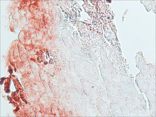 Immunohistochemistry (Formalin/PFA-fixed paraffin-embedded sections) - Anti-beta Catenin antibody (AB6302)
