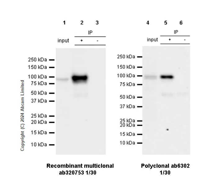 Immunoprecipitation - Anti-beta Catenin antibody (AB6302)