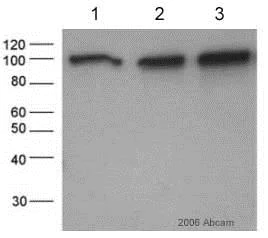 Western blot - Anti-beta Catenin antibody (AB6302)
