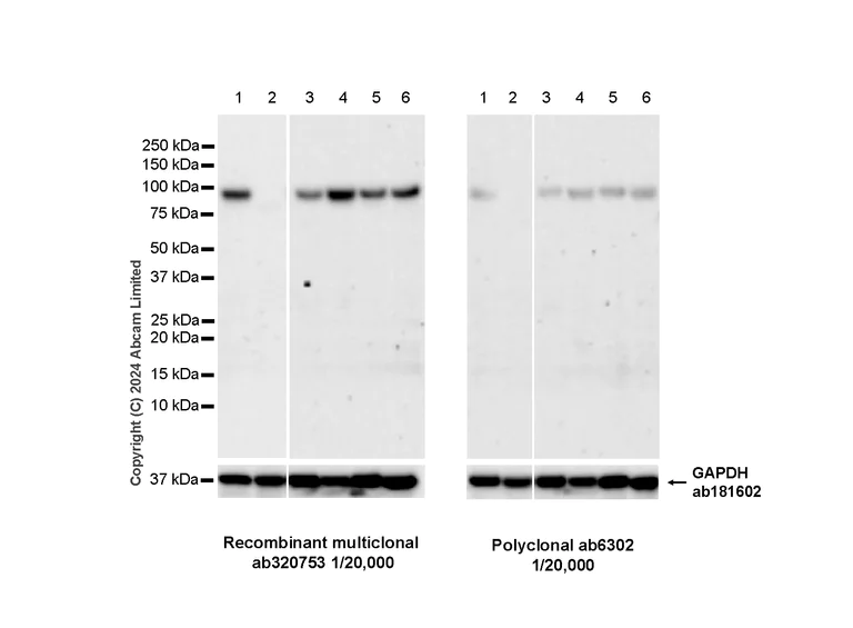 Western blot - Anti-beta Catenin antibody (AB6302)