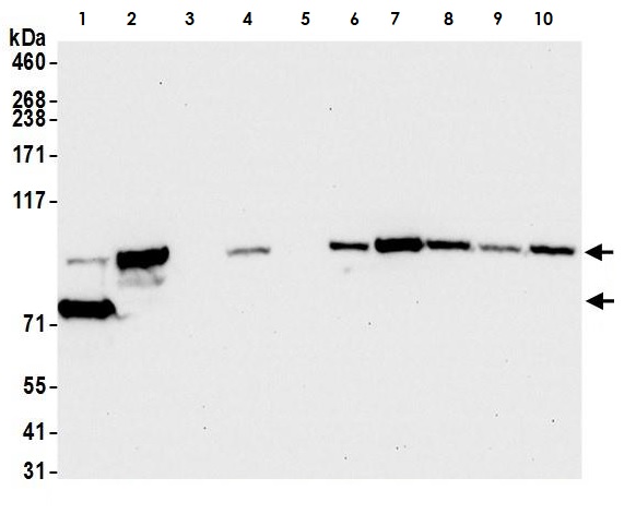 Western blot - Anti-beta Catenin antibody [BLR086G] (AB265591), expandable thumbnail