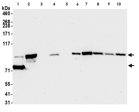 Western blot - Anti-beta Catenin antibody [BLR086G] (AB265591)