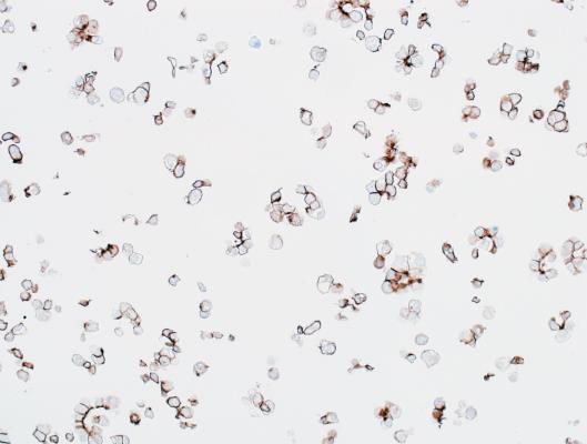Immunocytochemistry - Anti-beta Catenin antibody [BLR086G] - BSA free (AB272069), expandable thumbnail